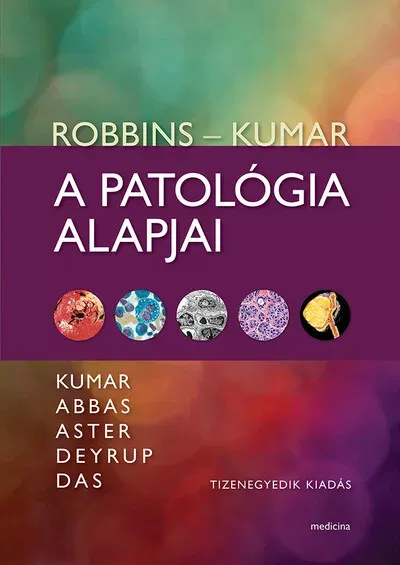Robbins - Kumar: A patológia alapjai (11. kiadás) Utolsó esély