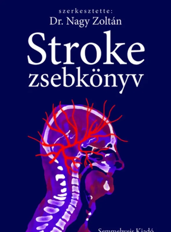 STROKE ZSEBKÖNYV Alacsony ár