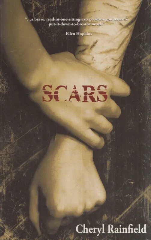 Vedd meg most Scars